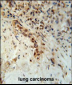 DCLRE1C Antibody (N-term)